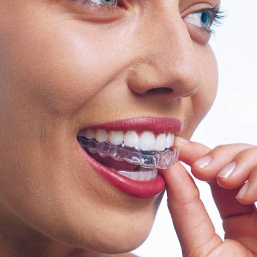 Invisalign